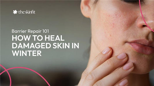 Barrier Repair 101 How to Heal Damaged Skin in Winter