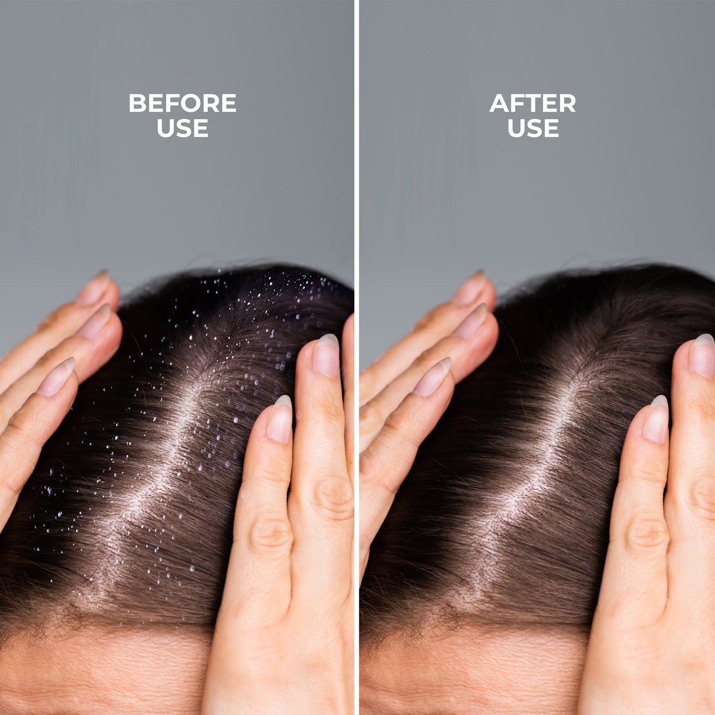 Framesi Scalp Refresh Spray 100ml