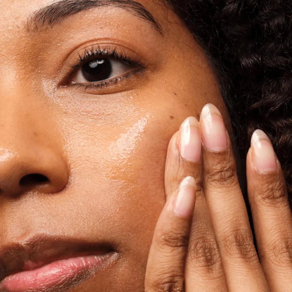 The Ordinary Niacinamide 10% + Zinc 1% 30ml - TheSkinFit
