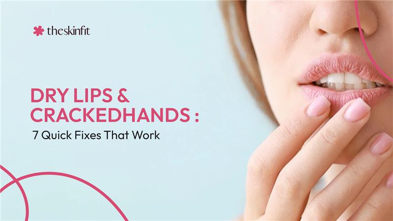 Dry Lips & Cracked Hands: 7 Quick Fixes That Work