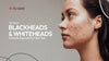 Conquer Blackheads and Whiteheads: A Gentle Approach to Clear Skin