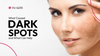 What Caused Dark Spots and What Can Help