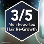 Regaine 5% Minoxidil Topical Solution Men Hair Regrowth Treatment