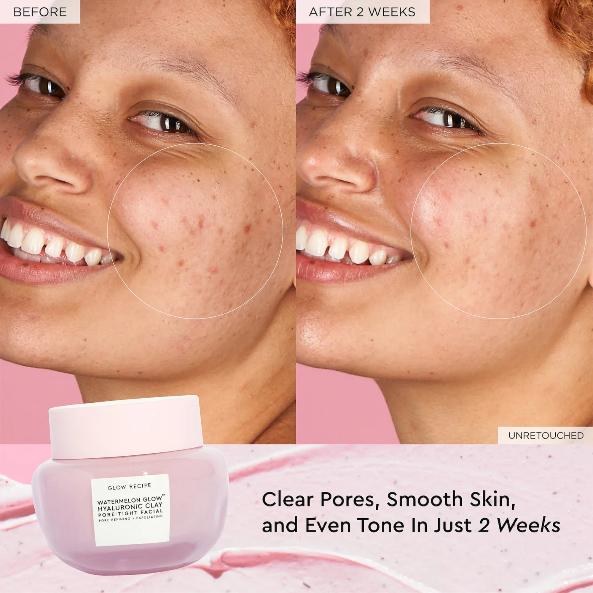 Glow Recipe Watermelon Glow Hyaluronic Clay Pore Tight Facial 25ml