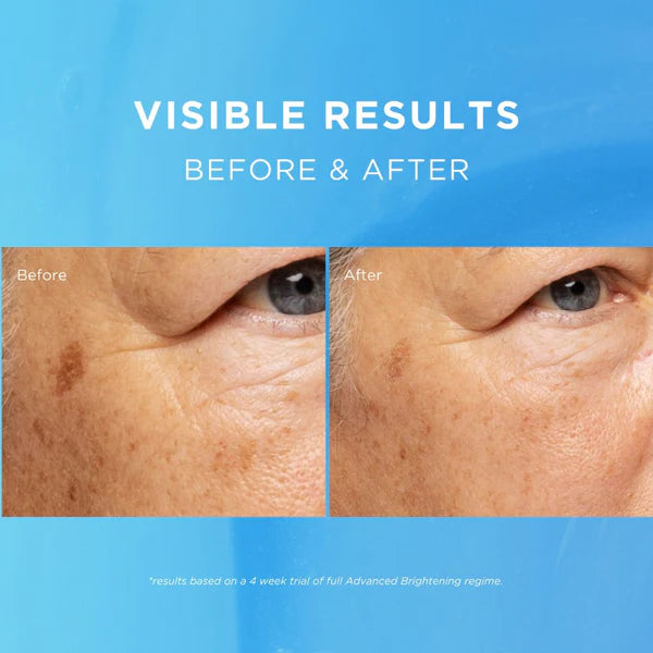 Fade Out Skincare Advanced Whitening Day Cream SPF20 75ml