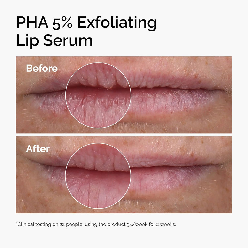 The Ordinary PHA 5% Exfoliating Lip Serum 15ml