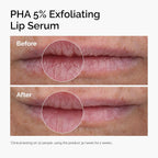 The Ordinary PHA 5% Exfoliating Lip Serum 15ml