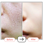 AccuFix Cosmetics AccuPair Skin Barrier Repair Cream with Ceramides