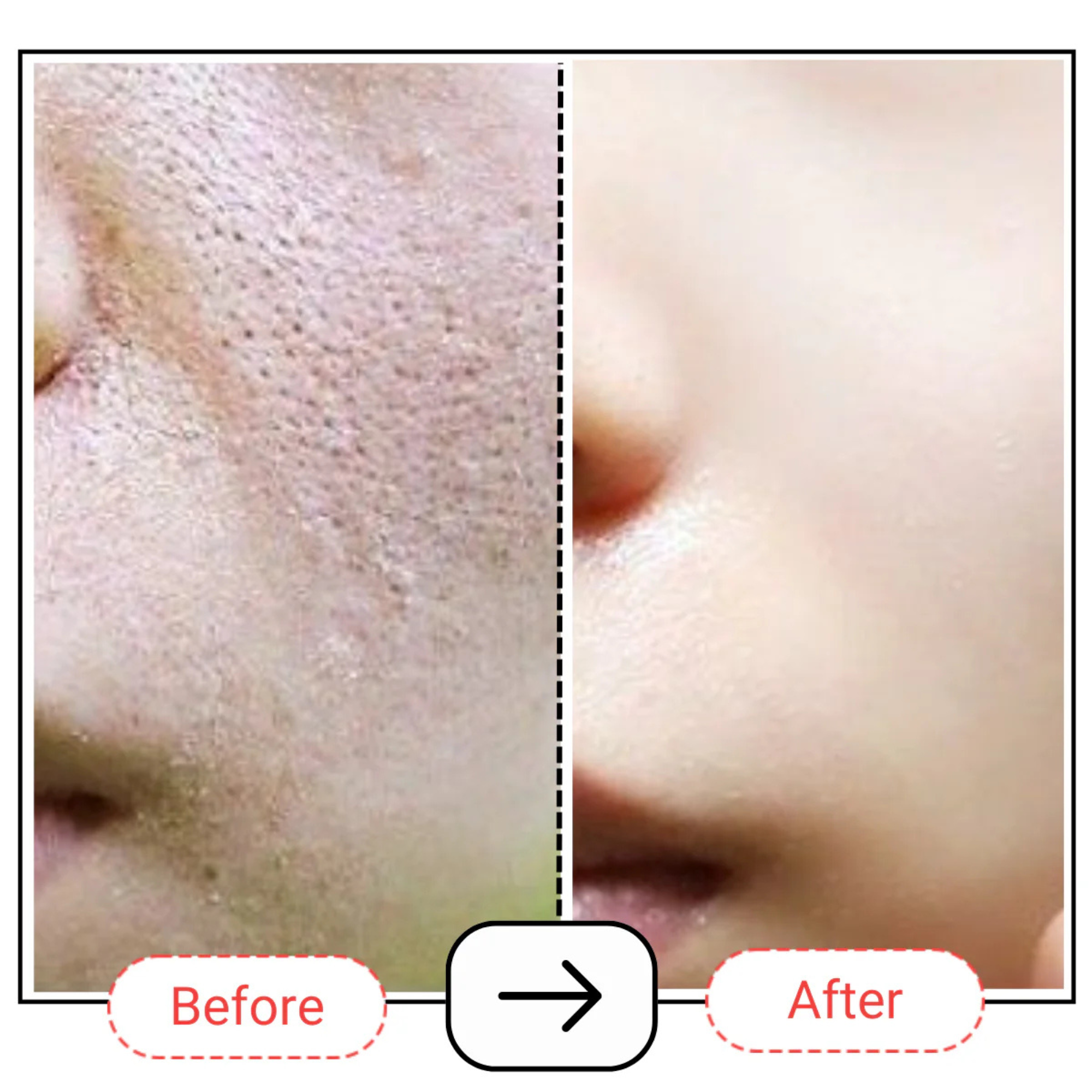 AccuFix Cosmetics AccuPair Skin Barrier Repair Cream with Ceramides