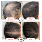 AccuFix Cosmetics Accugrow Advanced Hair Growth Serum