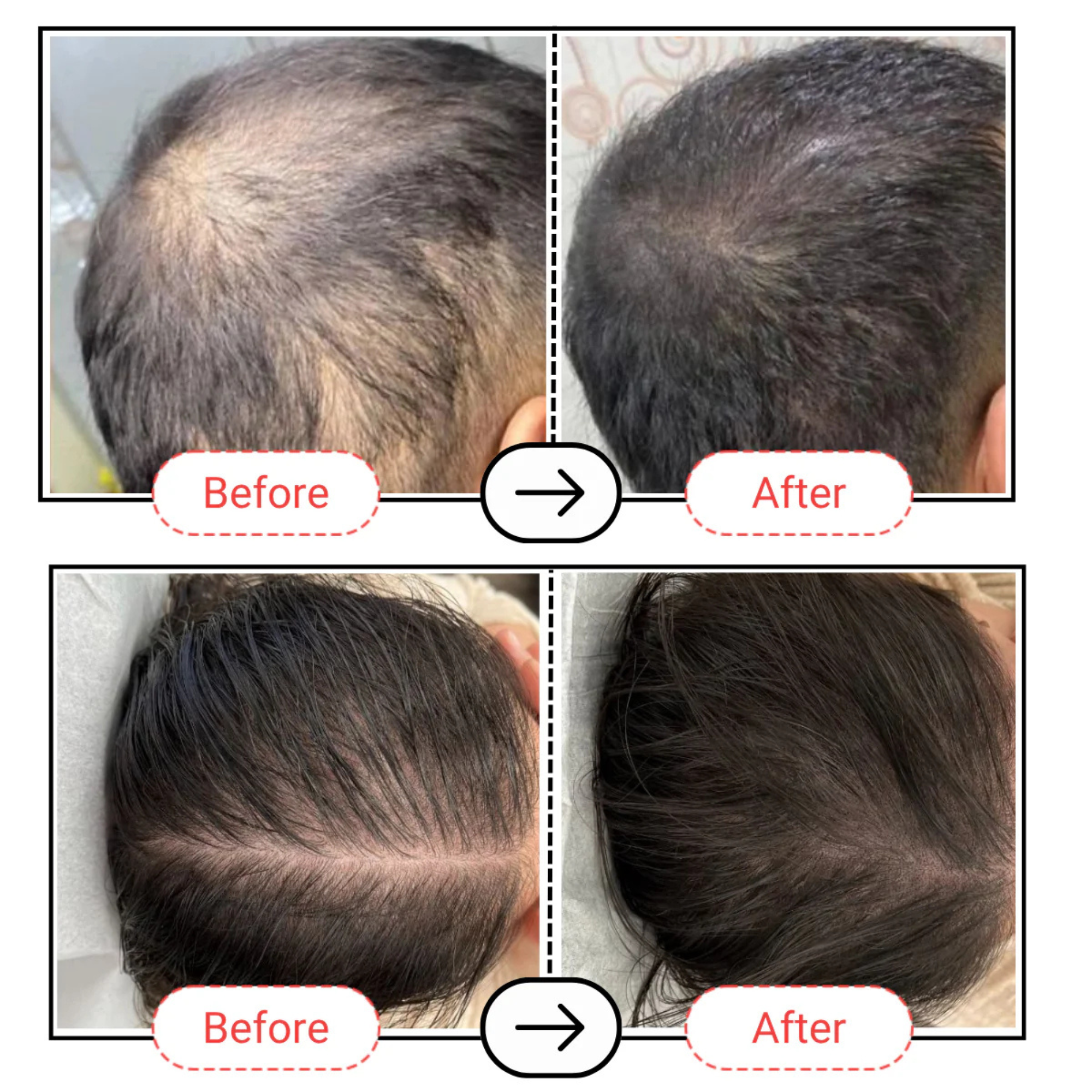AccuFix Cosmetics Accugrow Advanced Hair Growth Serum