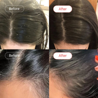 AccuFix Cosmetics Anti-Dandruff Salicylic Acid Shampoo