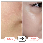 AccuFix Cosmetics Carbamide Intensive Hydration Cream
