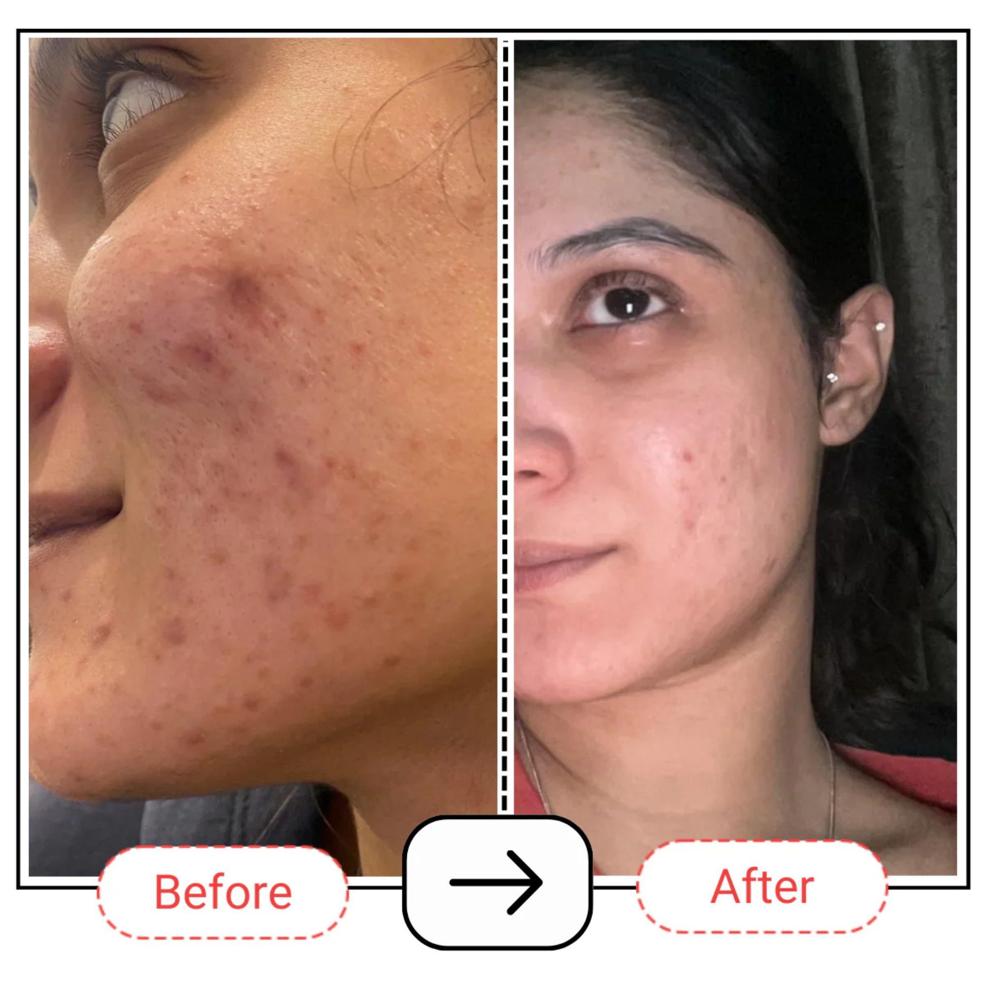 AccuFix Cosmetics Crème B3-B5-E | 4% Niacinamide Cream