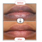 AccuFix Cosmetics Dark Lips Treatment Balm