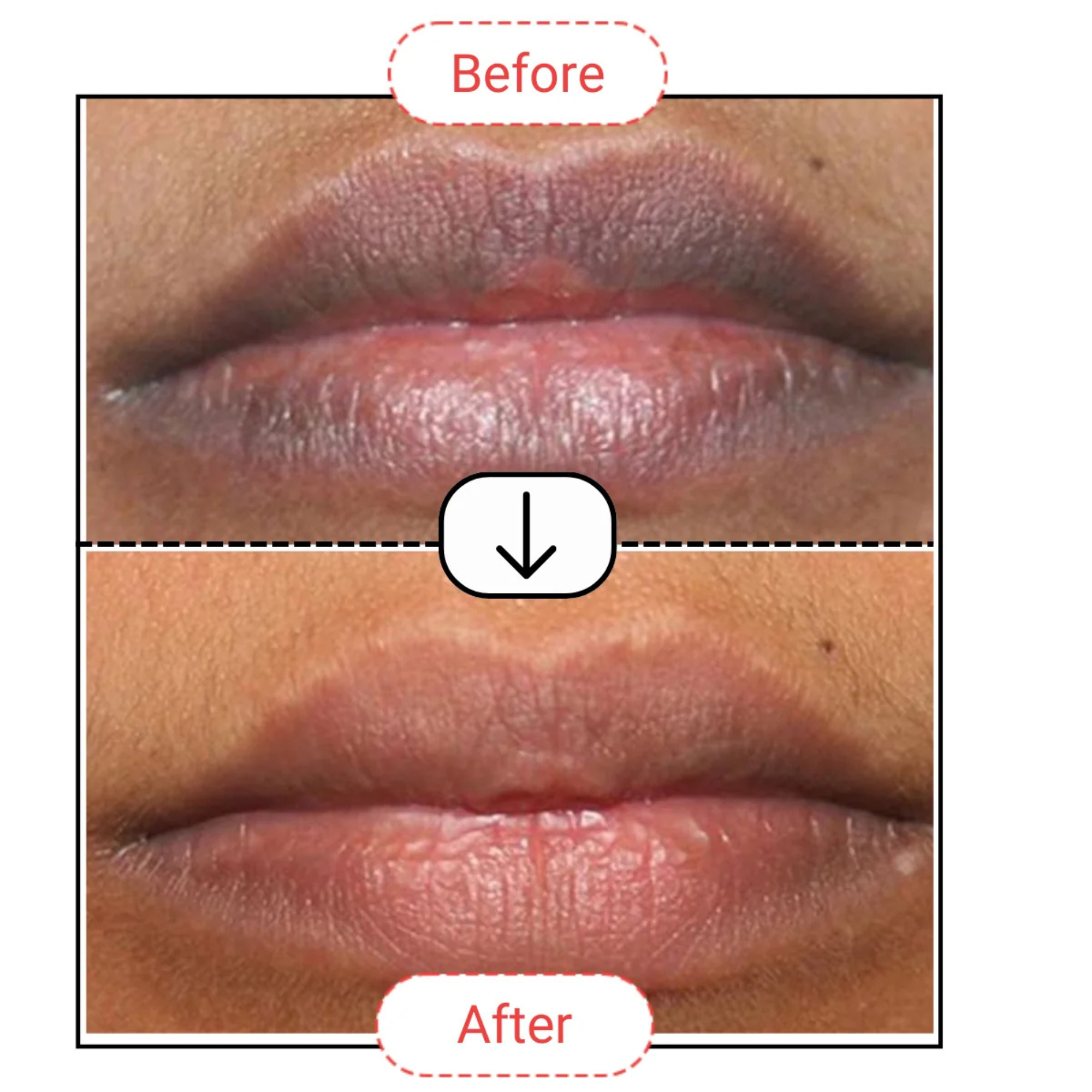 AccuFix Cosmetics Dark Lips Treatment Balm