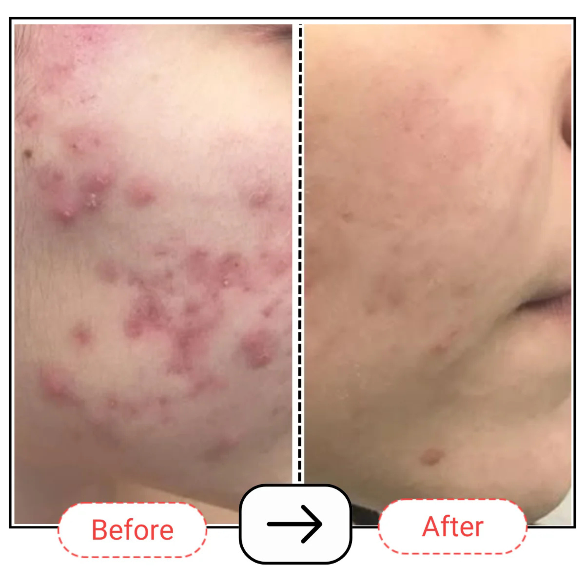 AccuFix Cosmetics Encapsulated 0.1% Salicylic Acid & Niacinamide Serum