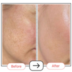 AccuFix Cosmetics Gentle Foaming Gel Face Wash