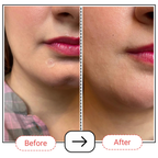 AccuFix Cosmetics Hydrocolloid Pimple Patches