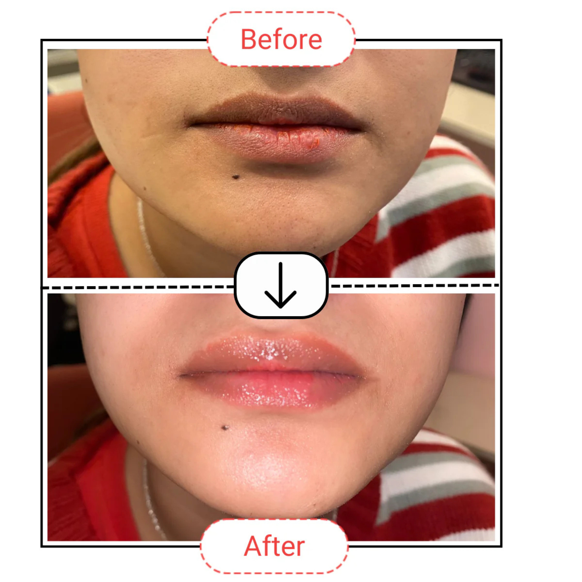 AccuFix Cosmetics Lip Protection Balm SPF 30+ PA++++