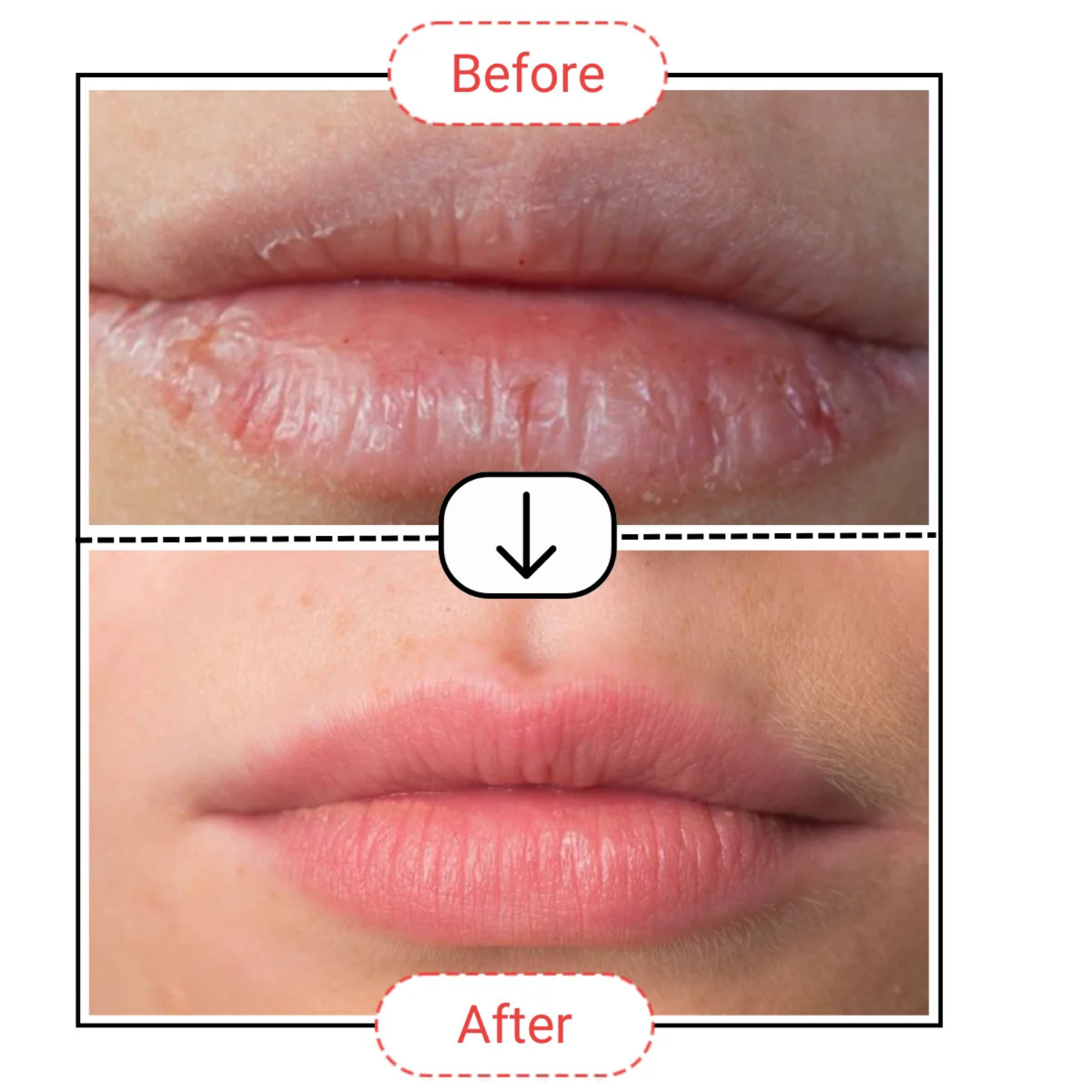AccuFix Cosmetics Lip Treatment Balm