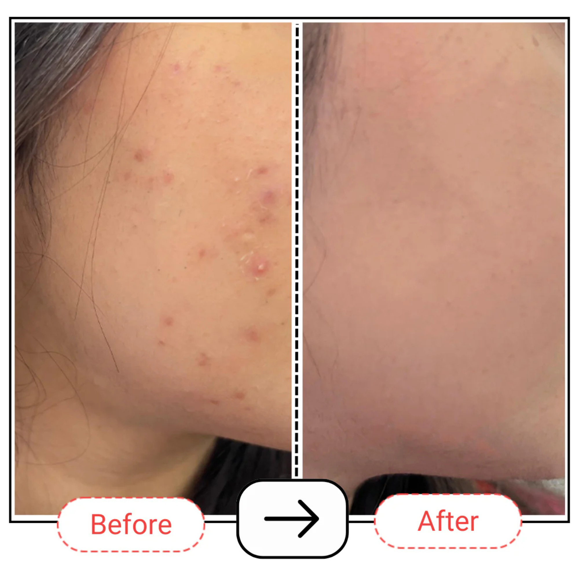 AccuFix Cosmetics Medium Chain Triglyceride (M.C.T.) Oil