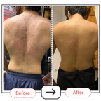 AccuFix Cosmetics Niacinamide Body Lotion