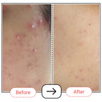 AccuFix Cosmetics Niacinamide Serum
