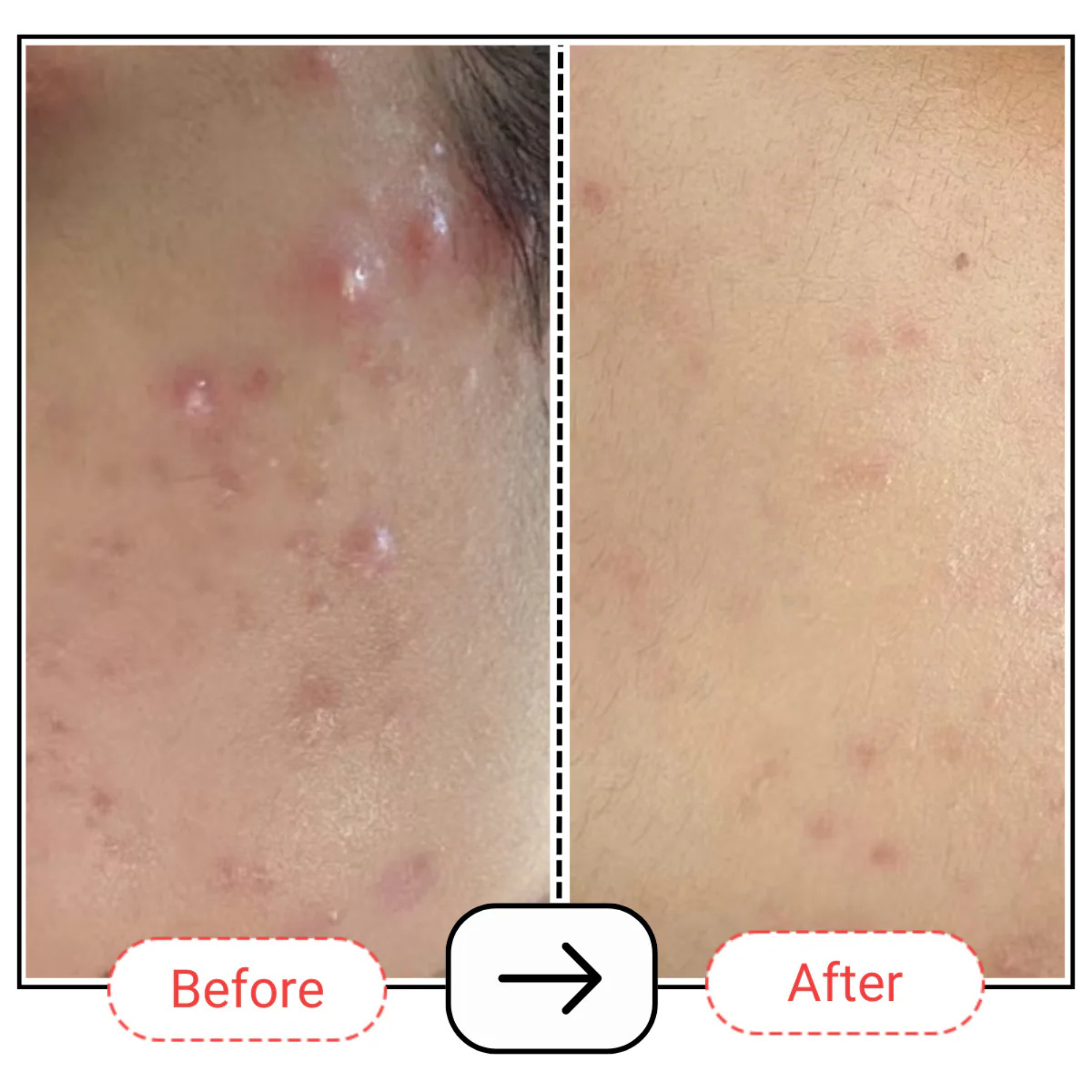 AccuFix Cosmetics Niacinamide Serum