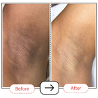 AccuFix Cosmetics Pitti-Fresh 2-in-1 Underarm Lightening Deo Cream