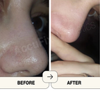 AccuFix Cosmetics Salicylic Acid Cream