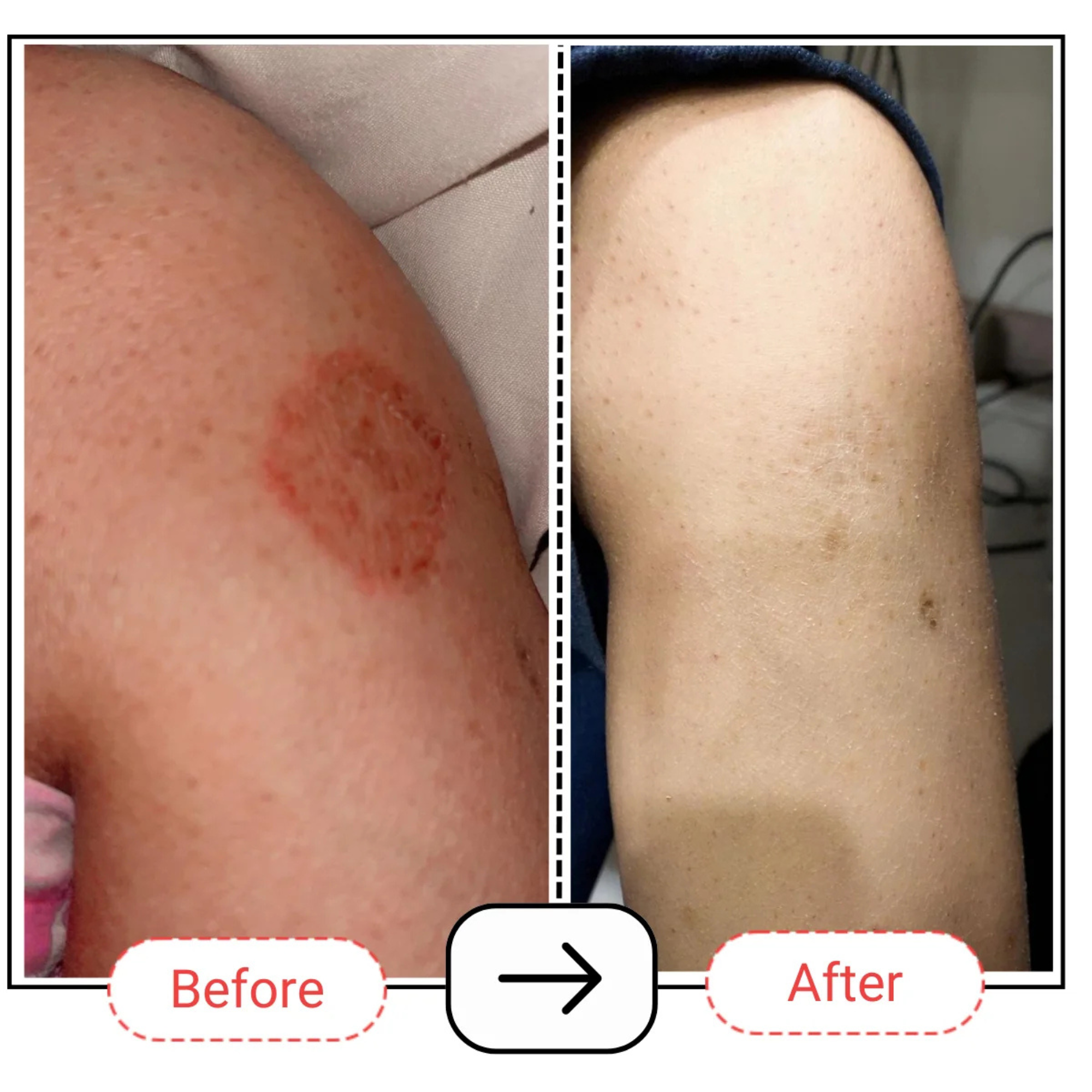 AccuFix Cosmetics Skin Repair Balm | Eczema, Cracked Heels
