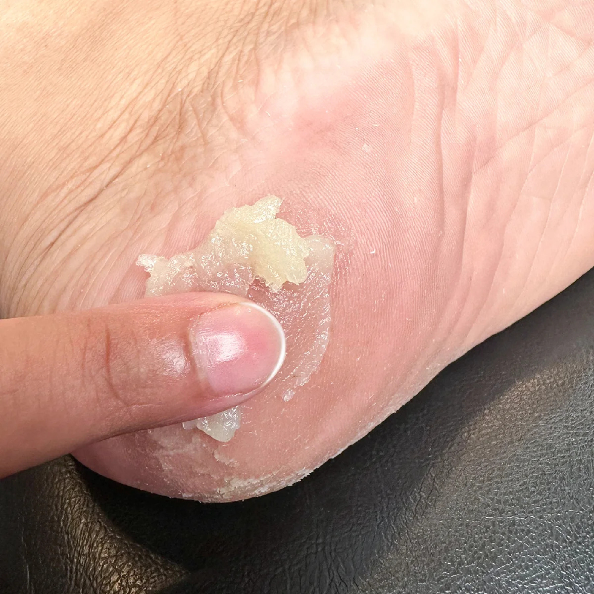 AccuFix Cosmetics Skin Repair Balm | Eczema, Cracked Heels