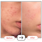 AccuFix Cosmetics Vitamin C Serum with 10% SAP