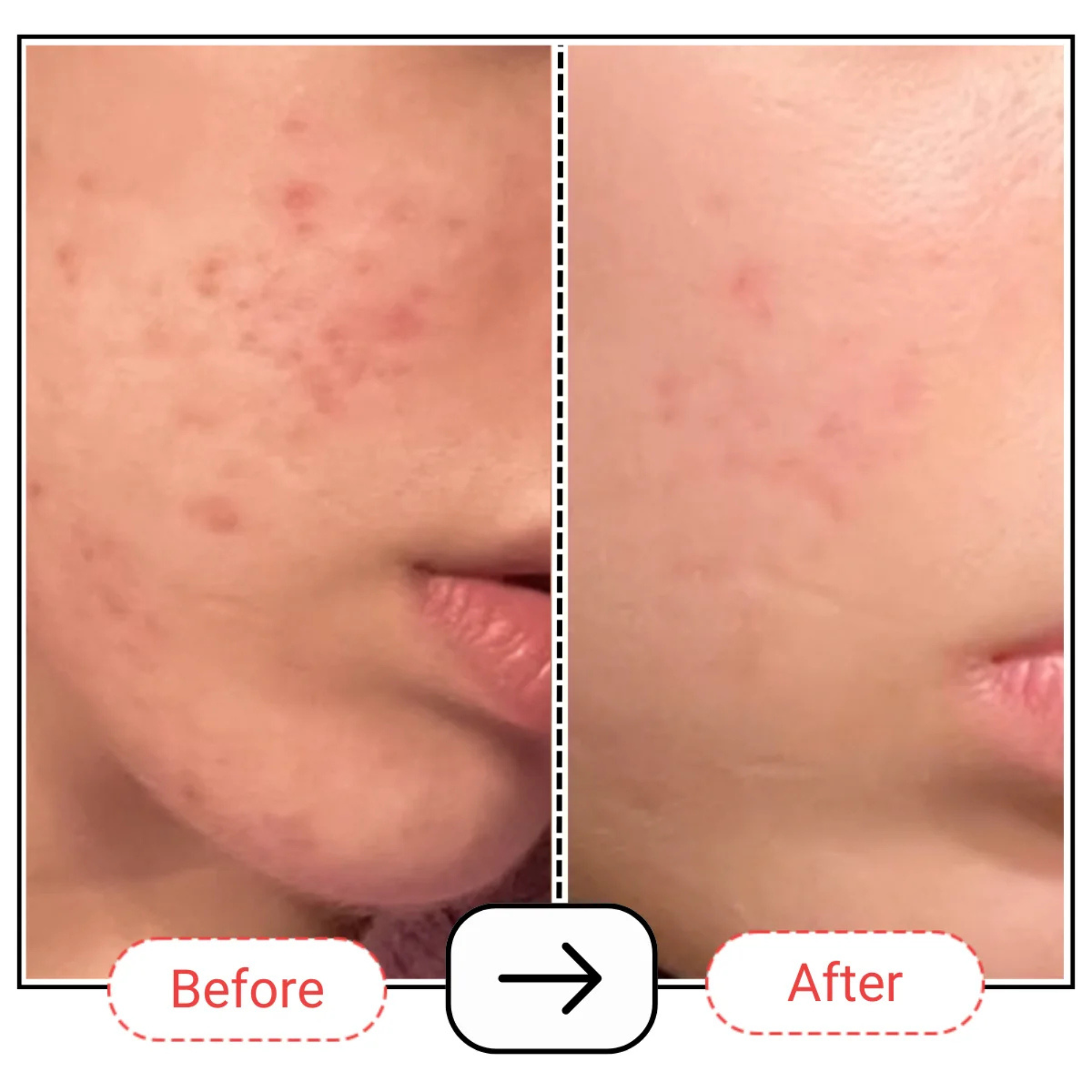 AccuFix Cosmetics Vitamin C Serum with 10% SAP
