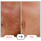 AccuFix Cosmetix Retin-oil Serum 0.2%