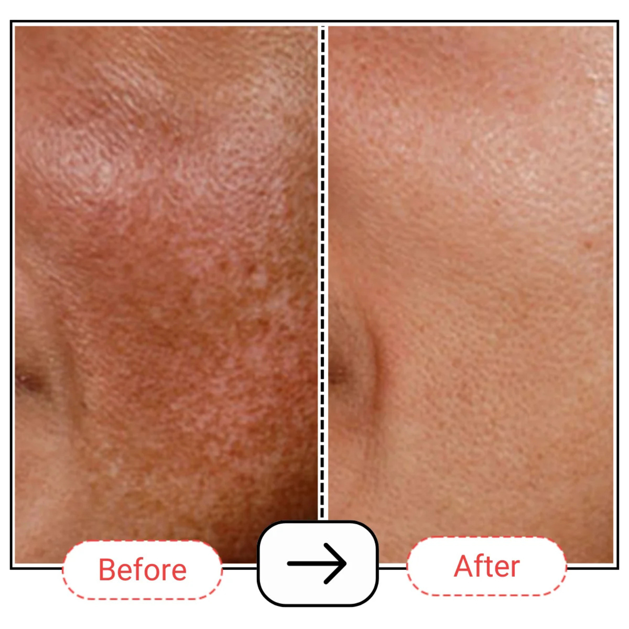 AccuFix Cosmetix Retin-oil Serum 0.2%