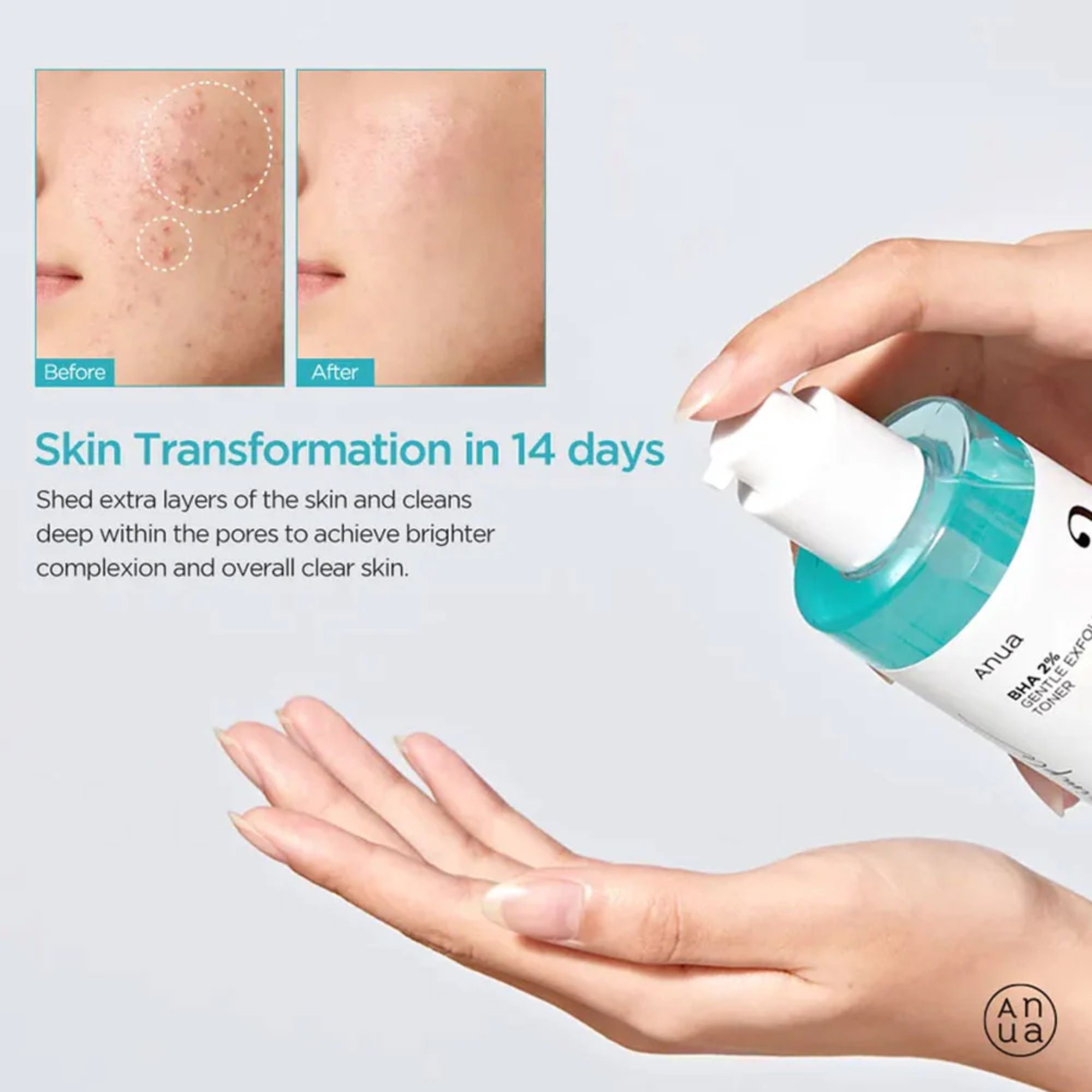 Anua BHA 2% Gentle Exfoliating Toner 150ml