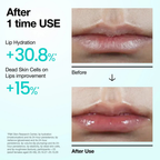 Anua PDRN Hyaluron Lip Serum