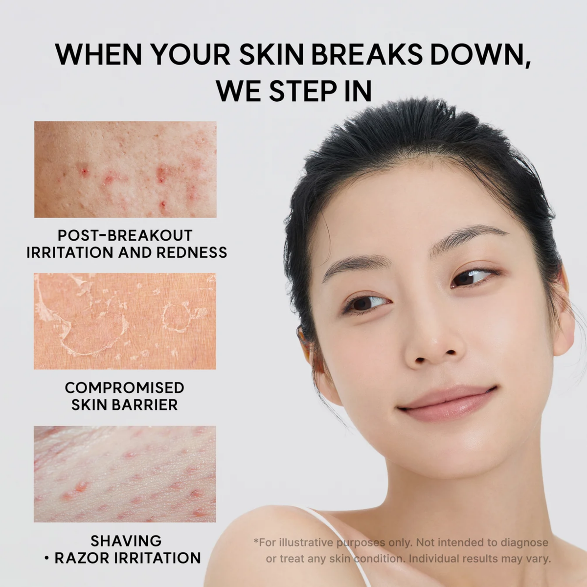 Arencia Eraser Shot Soothing Cream