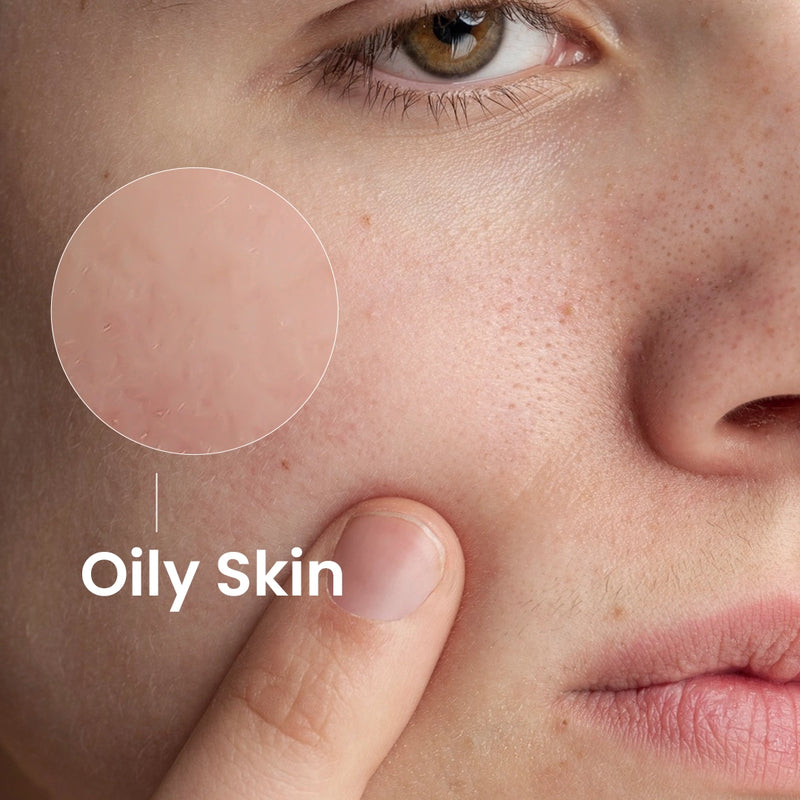 Oily Skin