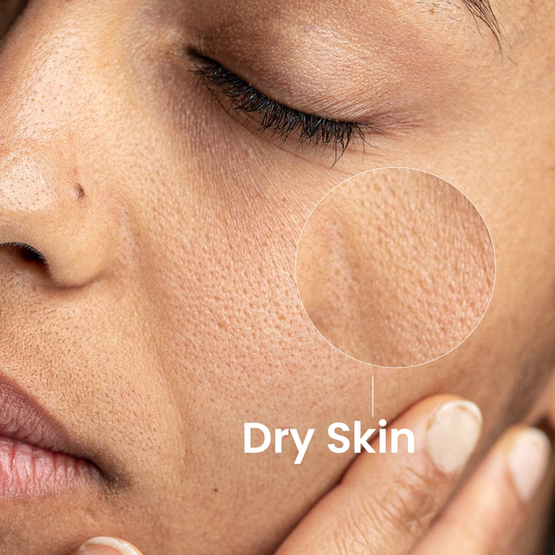Normal to Dry Skin