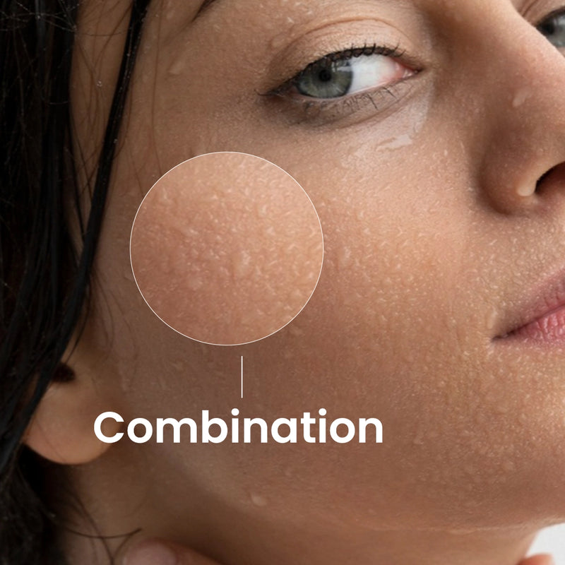Combination Skin