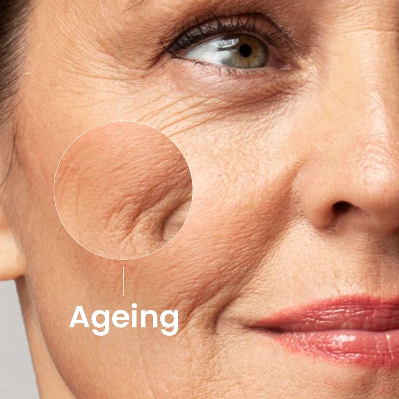 Anti Ageing
