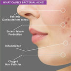 Beautenic Benzoyl Peroxide Acne Treatment Toner price in Pakistan