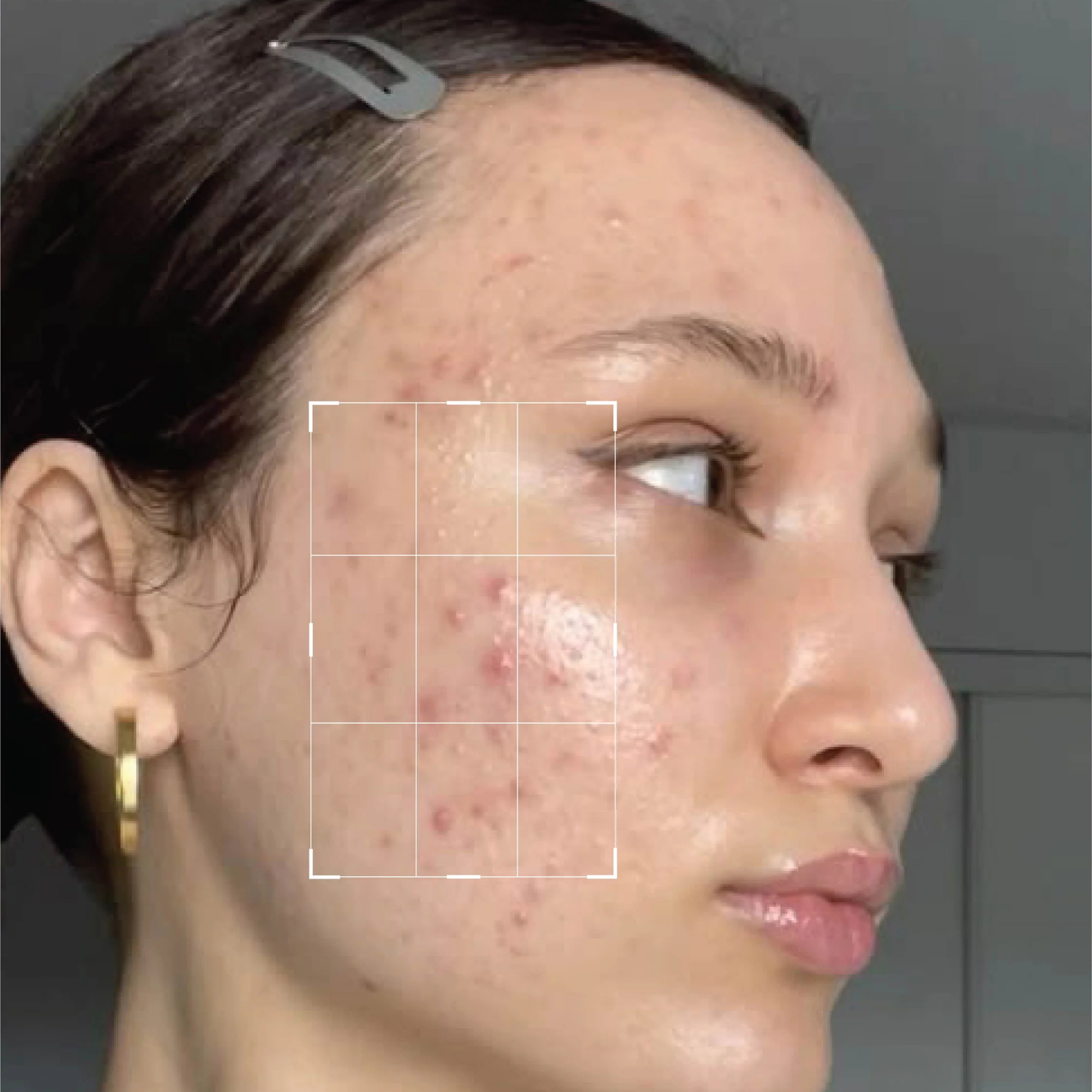 Beautenic Oil Control Facewash Tea Tree Oil+ Salicylic Acid price in Pakistan