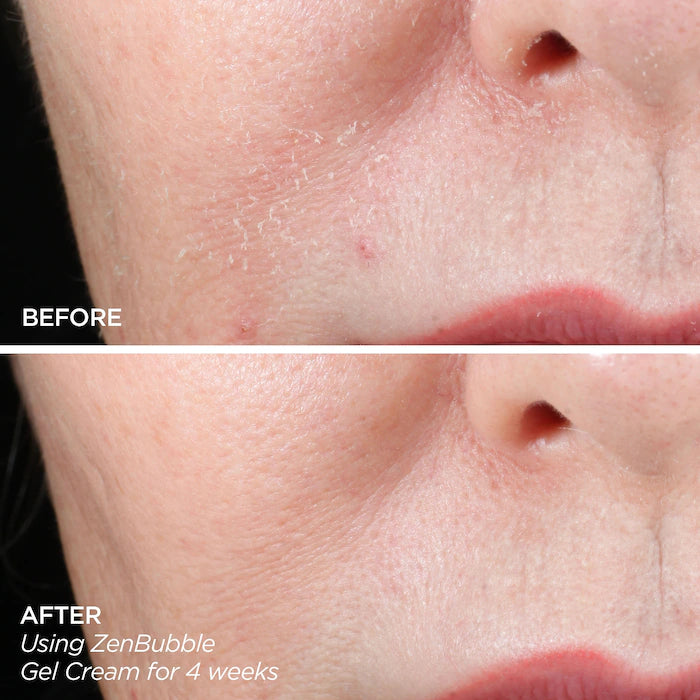 BeautyBio Get That Glow Glopro Facial Microneedling Discovery Set