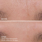BeautyBio Get That Glow Glopro Facial Microneedling Discovery Set in Pakistan