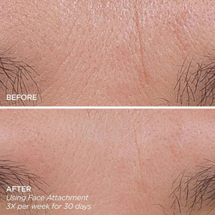 BeautyBio Get That Glow Glopro Facial Microneedling Discovery Set