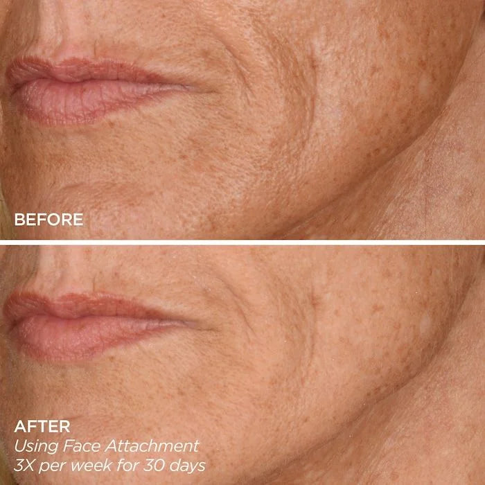 BeautyBio Get That Glow Glopro Facial Microneedling Discovery Set in Pakistan